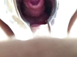 Urethral anal stick insertion 2