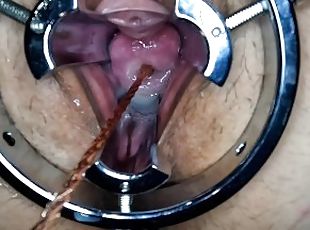 Cervix play and gaping pussy.
